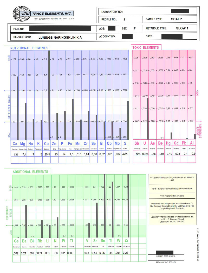 Exempel på svar från hårmineralanalys. Exempel på svar från hårmineralanalys.